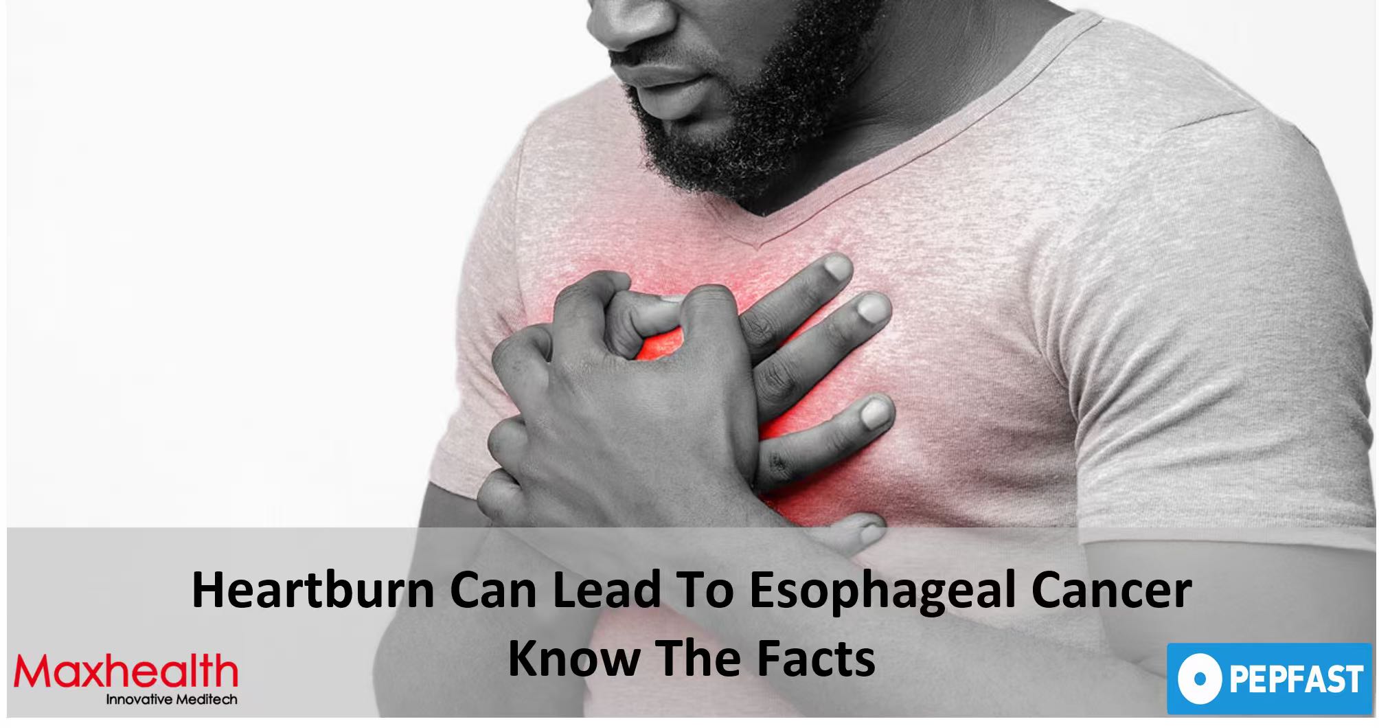 The Critical Link Between GERD and Esophageal Cancer, and a New Path to Clarity