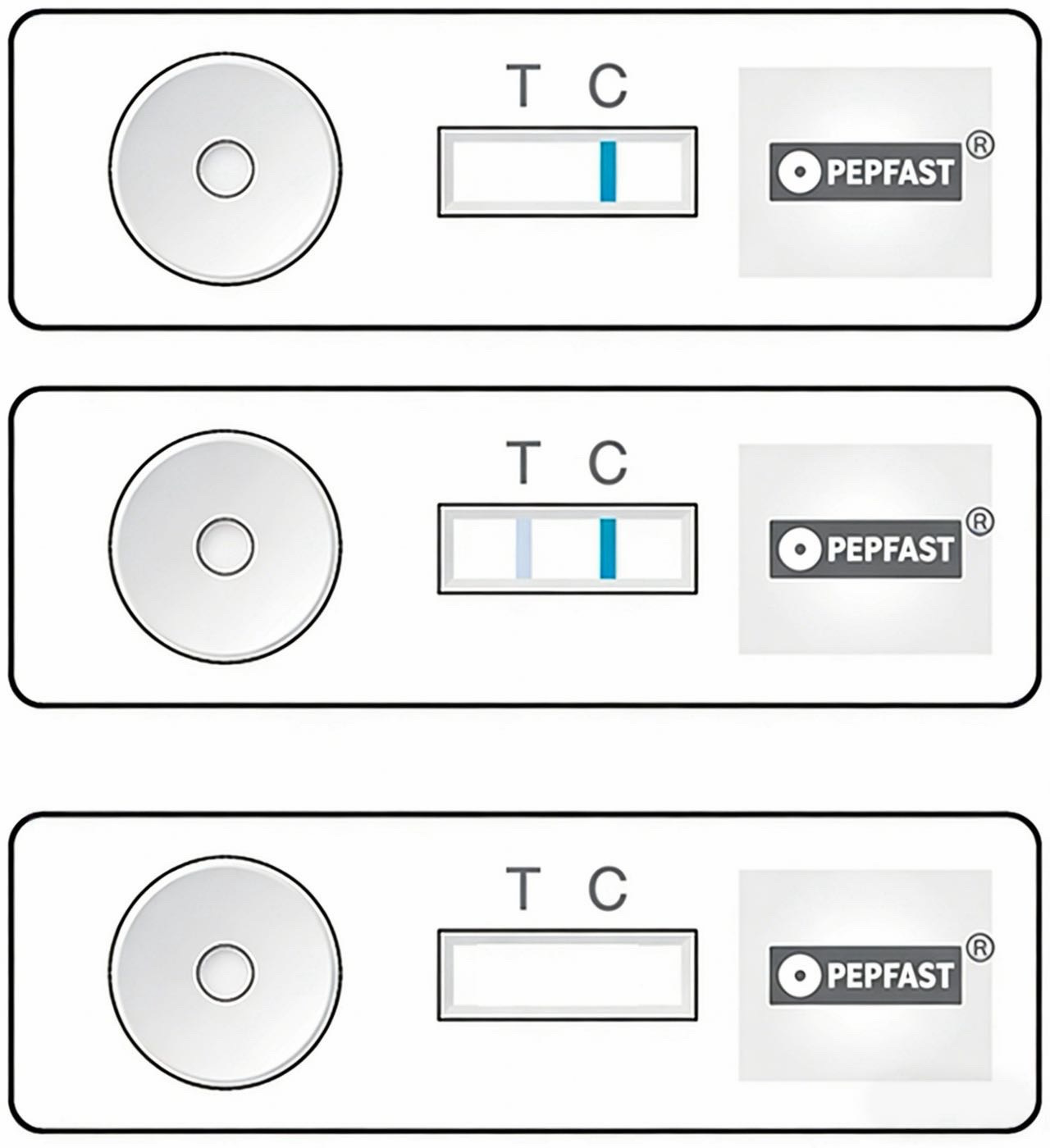 Cómo usar Pepfast para diagnosticar la enfermedad por reflujo gastroesofágico (ERGE)